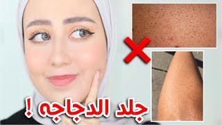 اسهل طريقه للتخلص من جلد الدجاجه في المنزل 😍🔥 ( تجربتي الشخصيه ) !! || شهد ناصر 🌸