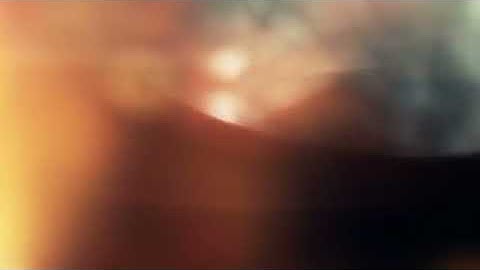 Light Leaks With Bokeh Background - Free HD 2020