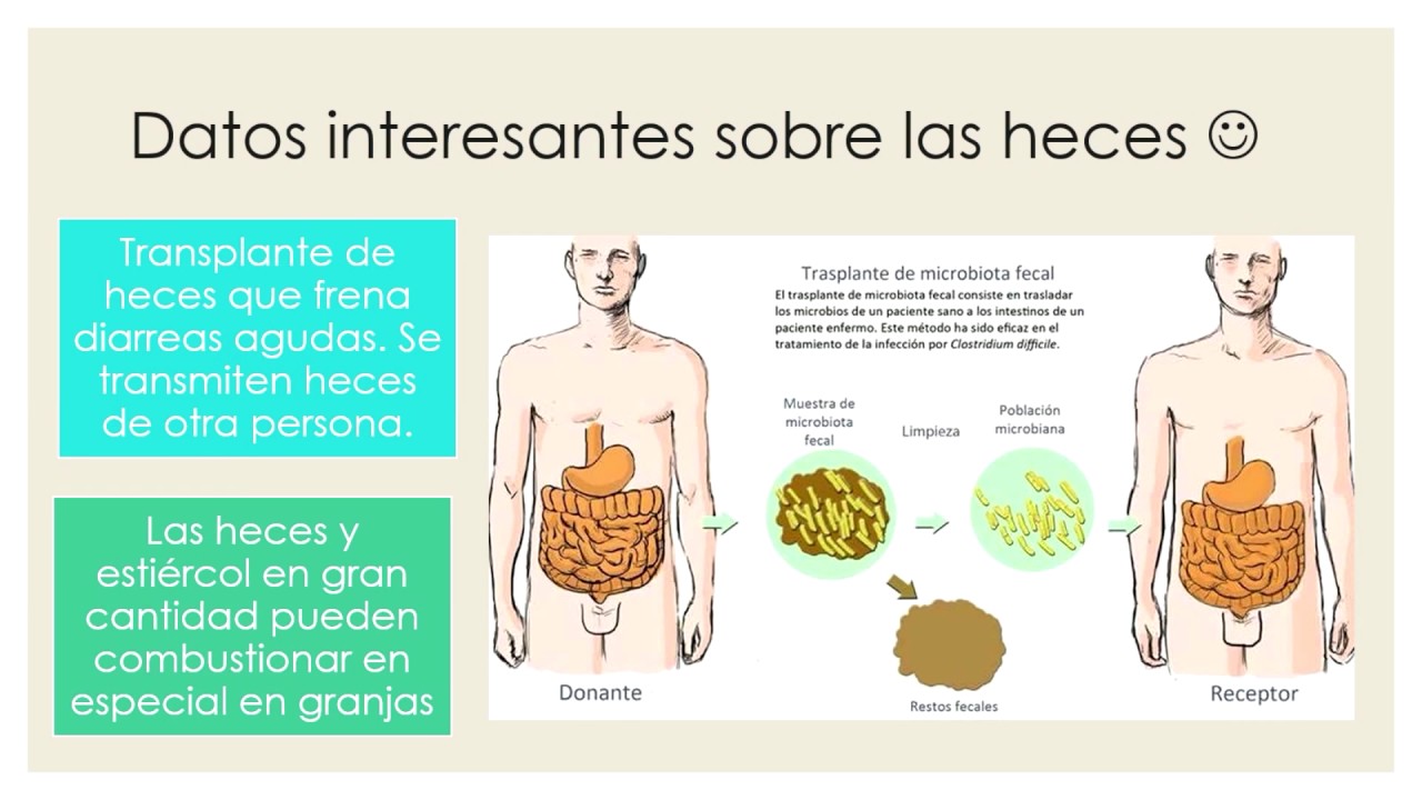 Adelgazamiento de heces