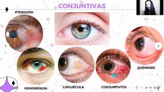 Semiología Examen Externo De Ojo