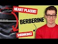 Berberine shrinks arterial plaque study shows