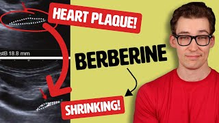 Berberine shrinks Arterial Plaque, Study Shows