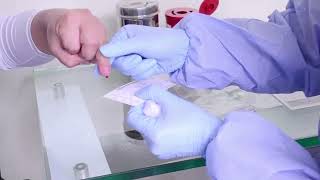 Toma de Muestra Capilar para Papel filtro