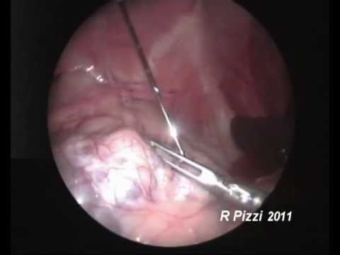 pizzicato fl studio Laparoscopic guided kidney biopsy in a dog