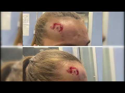 Así fue el ataque sufrido por las camareras de la cafetería heladería Míster Bubbles