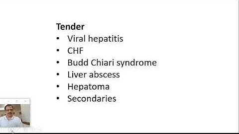 Approach to a case of hepatomegaly by Dr Arvind Kumar DAMS Faculty