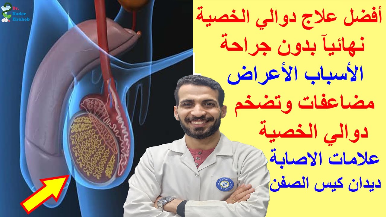 أفضل علاج دوالي الخصية نهائيآ بدون جراحة الأسباب الأعراض مضاعفات و تضخم دوالي الخصية ديدان كيس الصفن
