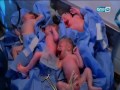 ازي الصحة | لقاء مع د. محمد مقبل ولحظة ولادة ٣ توائم وحدوث مفاجأة لأول مرة شاهد...!
