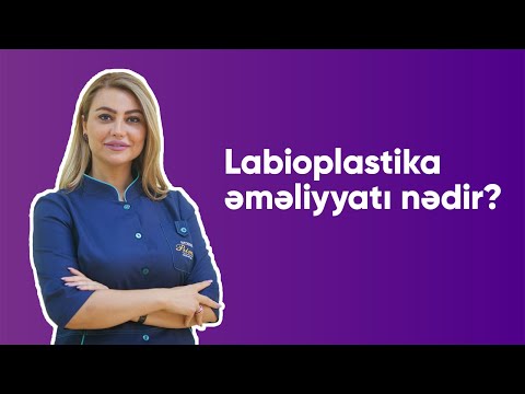 Video: Göndərmə əməliyyatı nədir?
