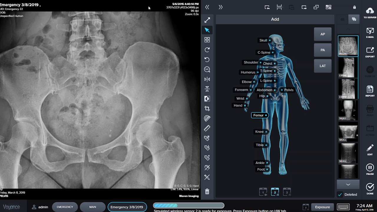 How to Acquire a new X-ray - YouTube