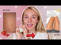 The TRUTH About How I Fixed My Keratosis Pilaris | My Experience with Truly Beauty