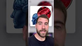 THE DIFFERENT TYPES OF BRAIN SCANS!