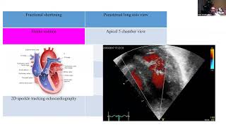 15 03 23 Professor Arvind Sehgal   Fetal growth restriction Broken Hearts