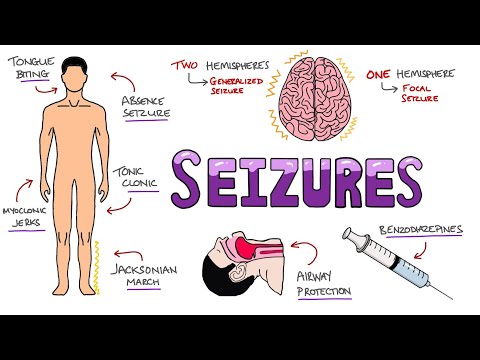 Seizures - Seizure Types | Generalized vs Focal Seizures | Causes of Seizures (Mnemonic)