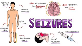 Seizures  Seizure Types | Generalized vs Focal Seizures | Causes of Seizures (Mnemonic)
