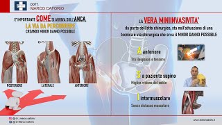 PROTESI D’ANCA MINI-INVASIVA - Rubrica di Informazione Medica screenshot 3