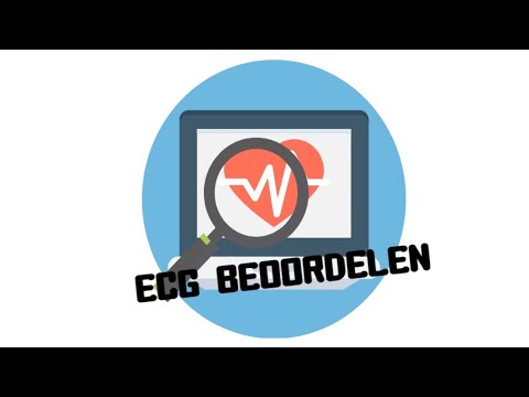 Video: Welke van de volgende voorbeelden zijn voorbeelden van afleiding door de bestuurder?