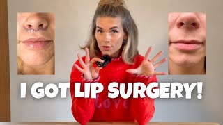 I Got Bullhorn Lip Lift Surgery 😳 | Before & After + My Honest Experience