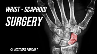 Wrist Surgery / Broken Scaphoid / @motogeo by MotoGeo 3,869 views 2 months ago 7 minutes, 12 seconds