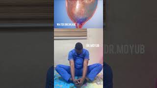 Four butterfly exercises for natural delivery