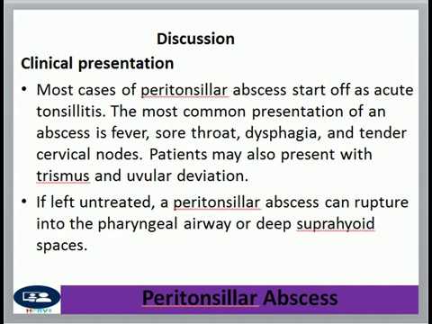 Peritonsillar abscess
