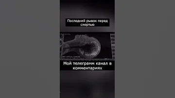 Что происходит с мозгом во время смерти #shorts