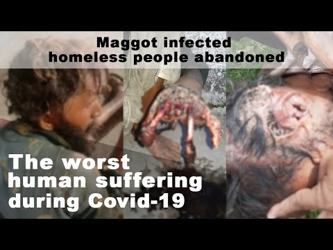 Human flesh-eating maggots infect homeless people: The worst human suffering during Covid-19