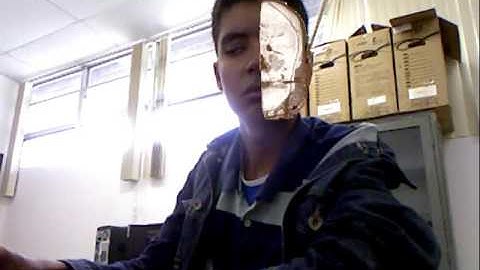 Improving On-Patient Medical Data Visualization in a Markerless AR Environment by Volume Clipping