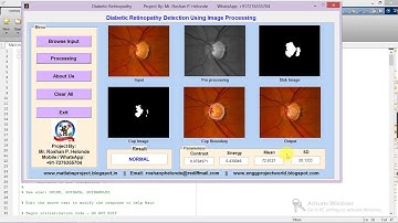 Diabetic Retinopathy Detection and Classification Using Matlab Project Code