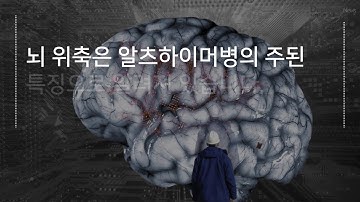 [디멘시아뉴스] 콜린-도네페질 병용 투여, 뇌 해마 위축 지연 확인