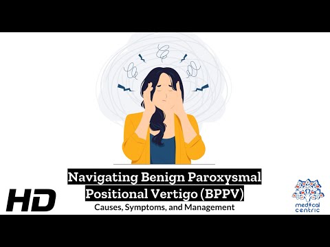 BPPV Unmasked: Understanding
