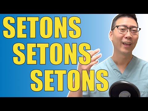 Video: Wat is seton plaatsing?