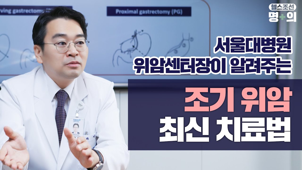 [위암 명의]서울대병원 위암센터장이 알려주는 '조기 위암' 최신 치료법