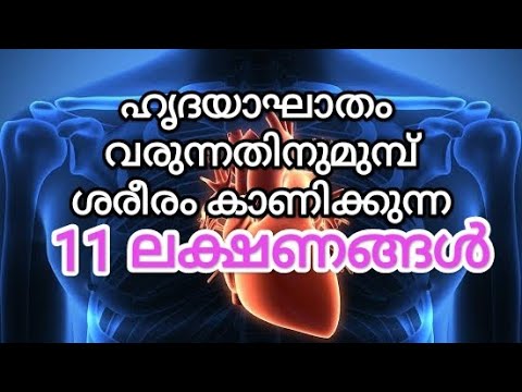 11 #Signs before #HeartAttack / Malayalam