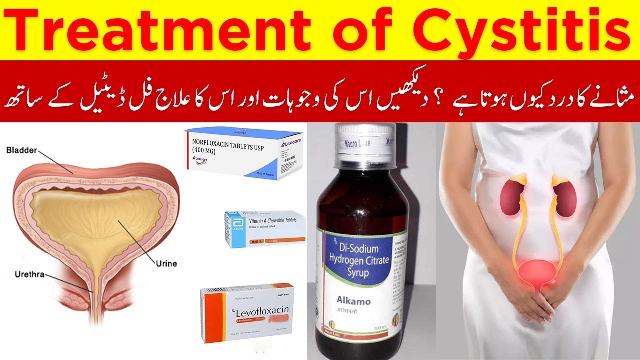Treatment of Cystitis Causes Sign and Symptoms What is Cystitis