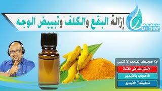 وصفة زيت الخرقوم السحرية لإزالة البقع والكلف وتبييض الوجه دكتور عماد ميزاب