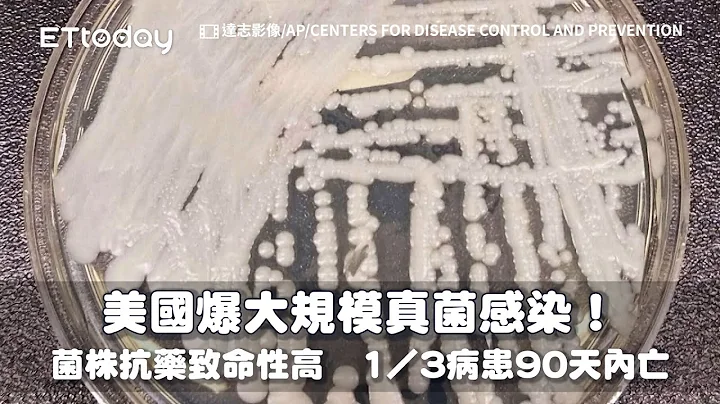 美国爆“大规模真菌感染”！菌株抗药致命性高1／3病患90天内亡 - 天天要闻