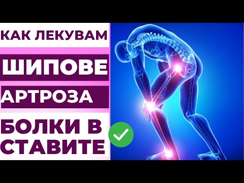 Видео: 10 естествени начина за облекчаване на болките в ставите на кавалерите