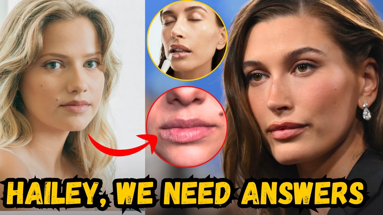 “Hailey Bieber’s Rhode Lip Treatment RUINED Her Lips?! 😳”
