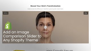 Add Before and After Image Slider in Shopify | Set up Image Comparison Slider on Any Shopify Theme