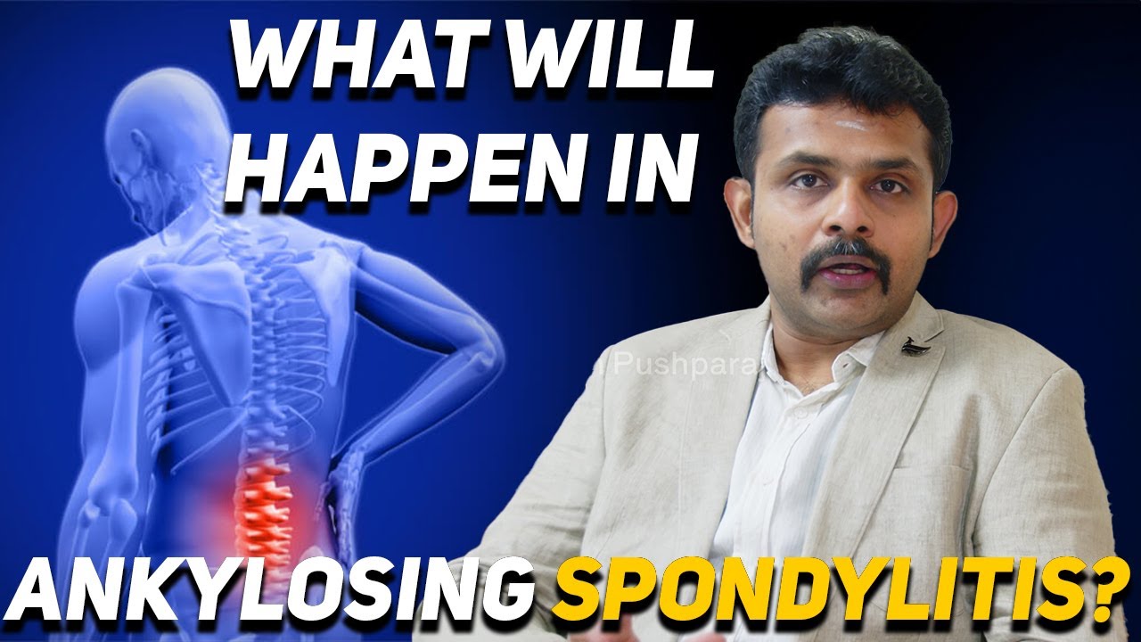 What will happen in Ankylosing Spondylitis with Dr. Vignesh Pushparaj | Expert Insights in Tamil