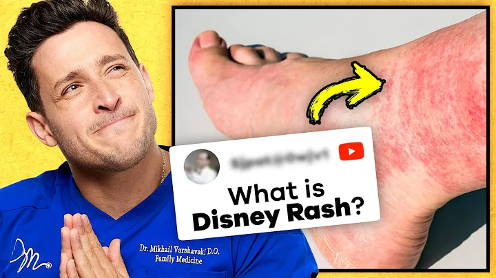 The Truth About The “Disney" Rash | RTC 38