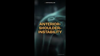 Anterior Shoulder Instability: Mastering the ISIS Score in 60 Seconds
