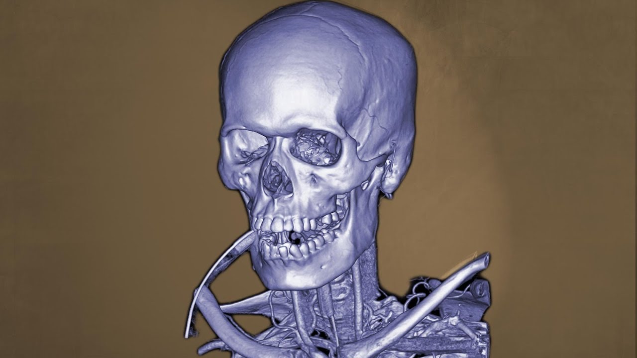 The Body After Eating Several Pounds Licorice Candy