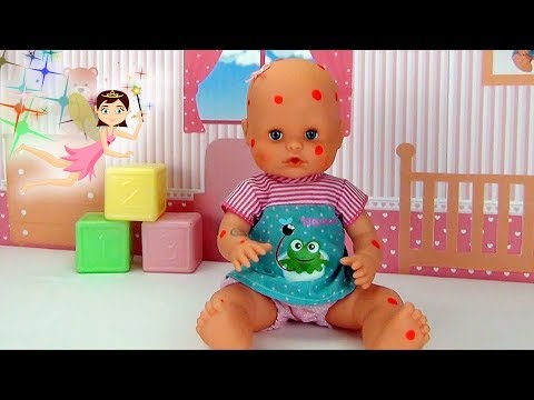 Bebé Nenuco tiene Varicela Muñeca enferma | Vídeos de Muñecas bebés YouTube