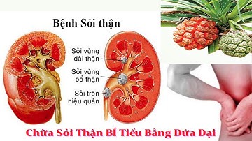 Bất Ngờ Tác Dụng Dứa Dại Chữa Bệnh Bí Tiểu l Sỏi Thận l Gia đình Win