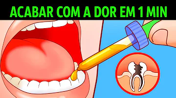 O que fazer para aliviar dor de dente com cárie?