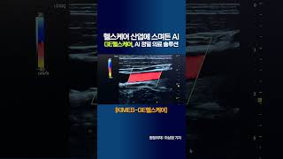 헬스케어 산업에 스며든 AI... GE헬스케어, AI 정밀 의료 솔루션 | [KIMES-GE헬스케어] (20250321)