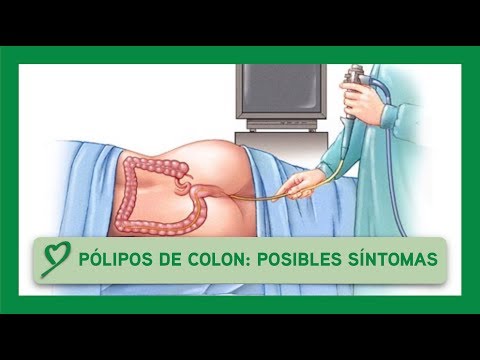 Vídeo: Pólipo Anal: Síntomas Y Tratamiento, Fotos, Causas, Diagnóstico