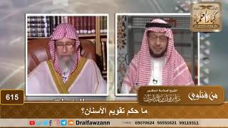 ما حكم تقويم الأسنان؟ الشيخ صالح الفوزان